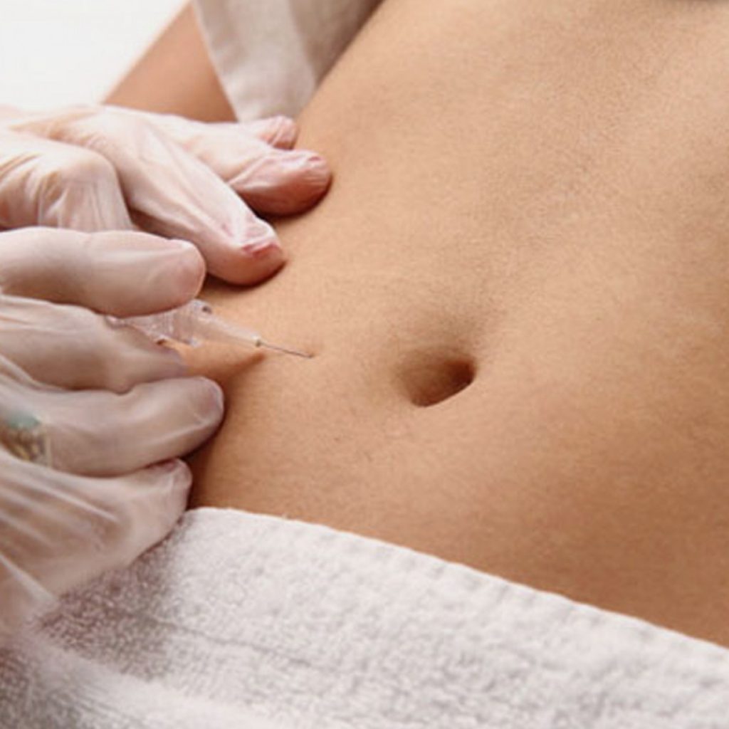 Carboxiterapia na Clínica PRIVÉ