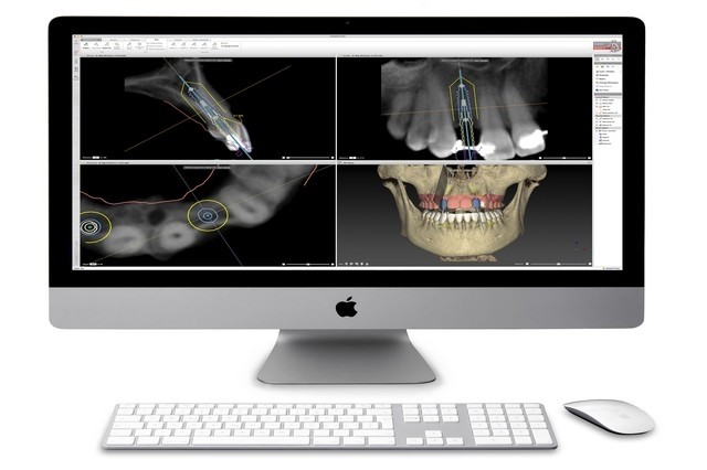 Cirurgia Guiada na Clínica PRIVÉ